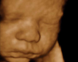 Image of '...the fetus is another life in a woman and loss of the fetus is actually loss of a child in the offing' Justice Midha stated.